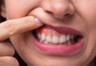 Gum Disease and Root Canals: Protecting Your Tooth Pulp